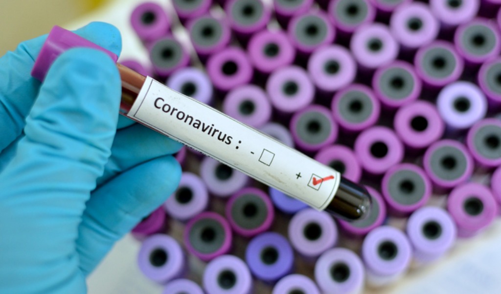 Coronavirus, decesso di altre due anziane. Il bilancio delle vittime sale a 23.