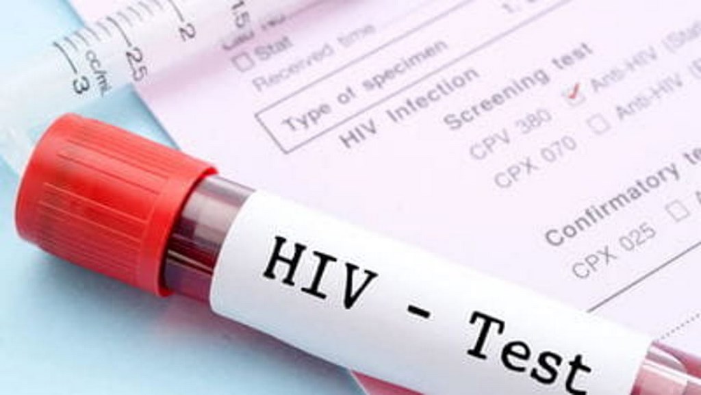 Malato di Aids, ha contagiato diversi partner. Arrestato per omicidio dopo la morte della compagna.